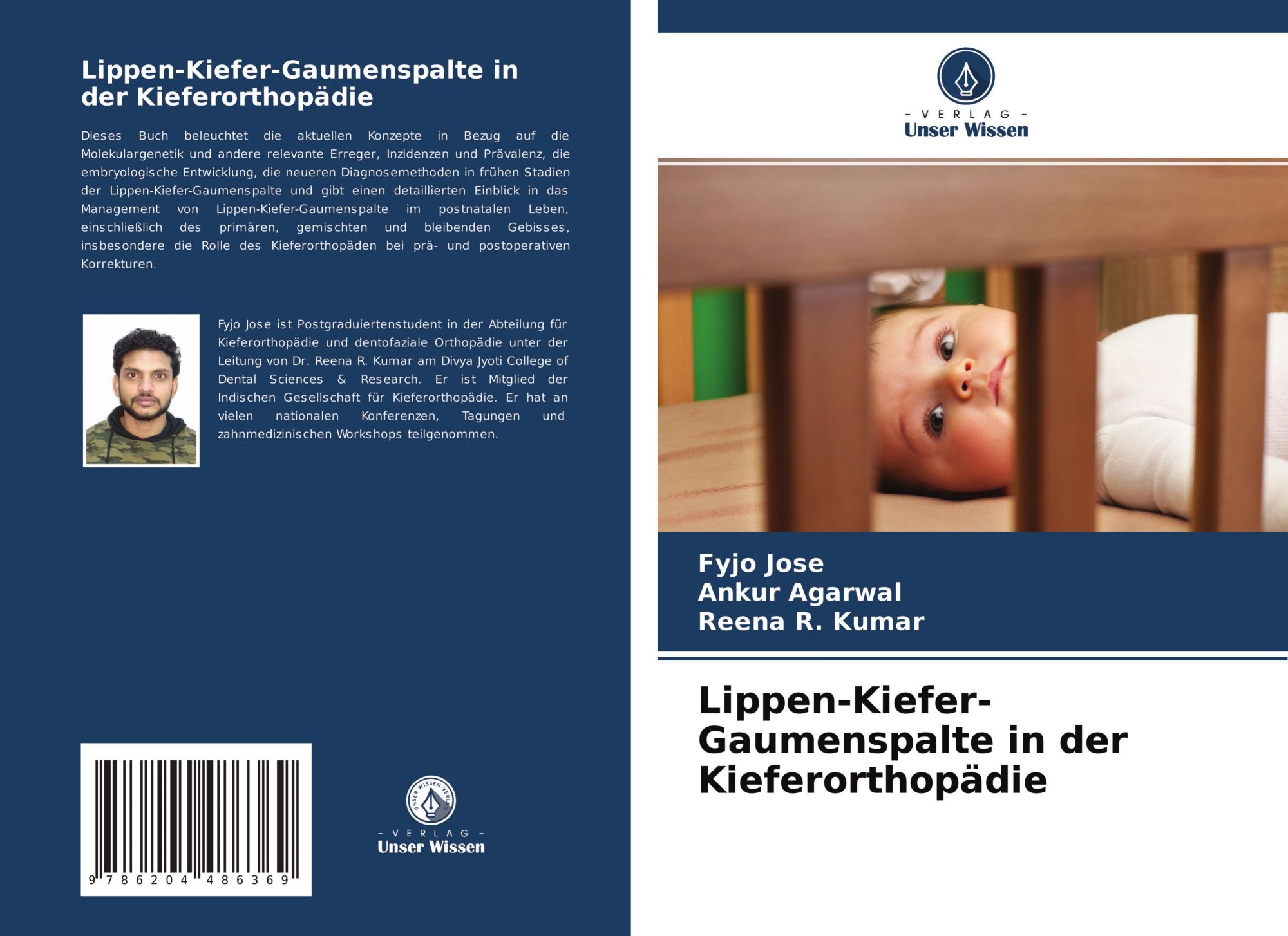 Cover: 9786204486369 | Lippen-Kiefer-Gaumenspalte in der Kieferorthopädie | Fyjo Jose (u. a.)