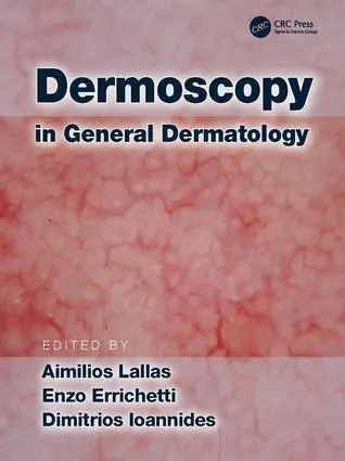 Cover: 9781138706569 | Dermoscopy in General Dermatology | Aimilios Lallas (u. a.) | Buch