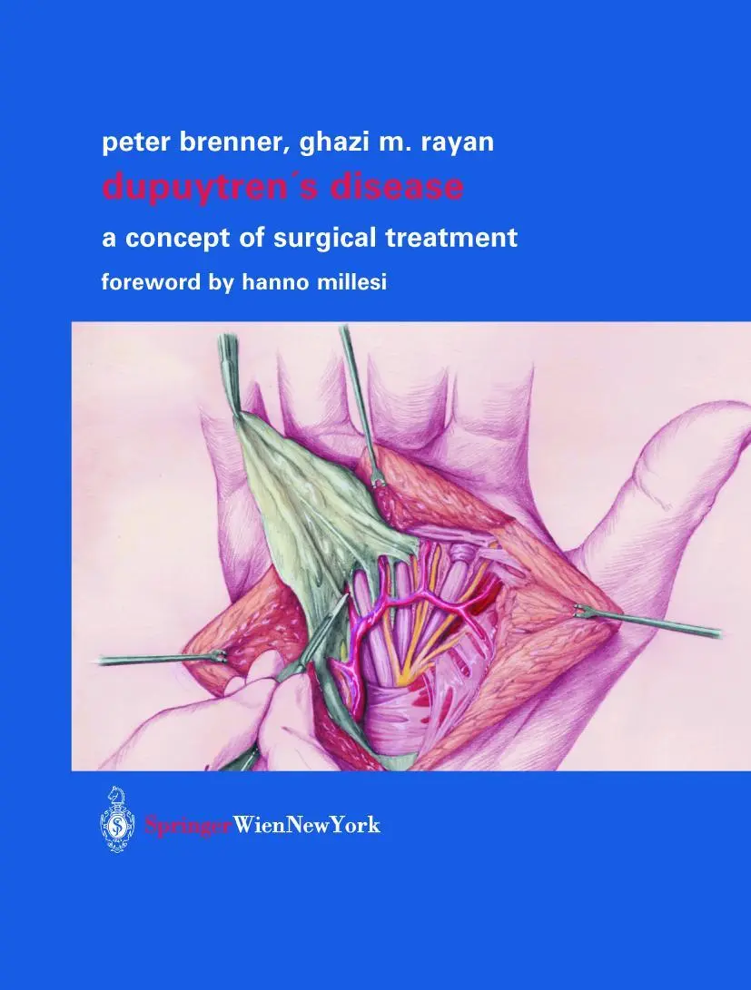 Cover: 9783211836569 | Dupuytren's Disease | A Concept of Surgical Treatment | Buch | 2003
