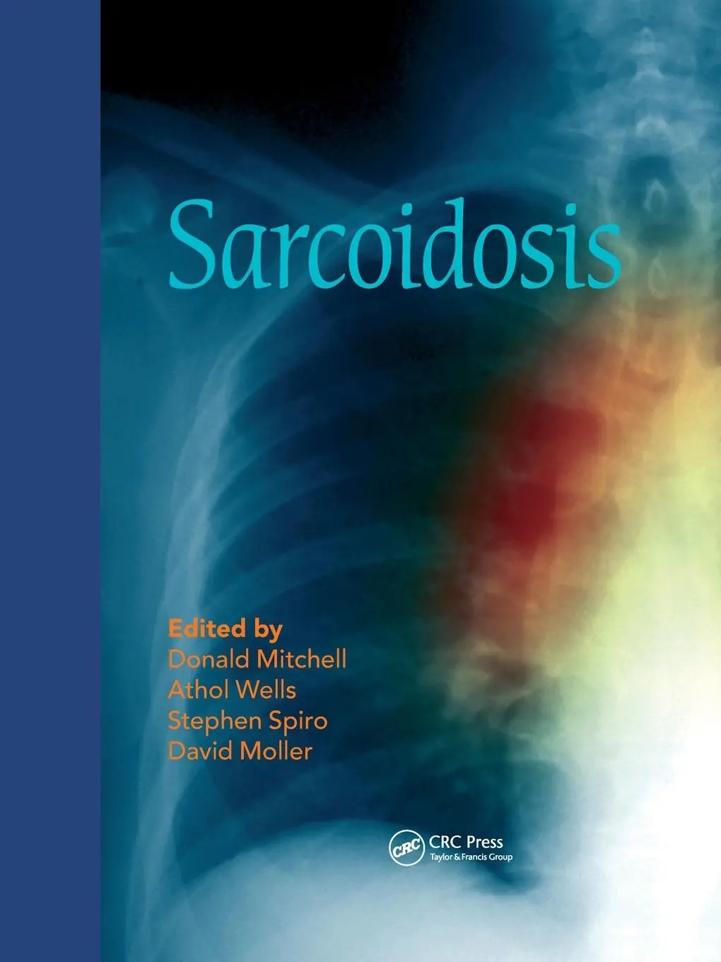 Cover: 9780367576769 | Sarcoidosis | Donald Mitchell (u. a.) | Taschenbuch | Englisch | 2020