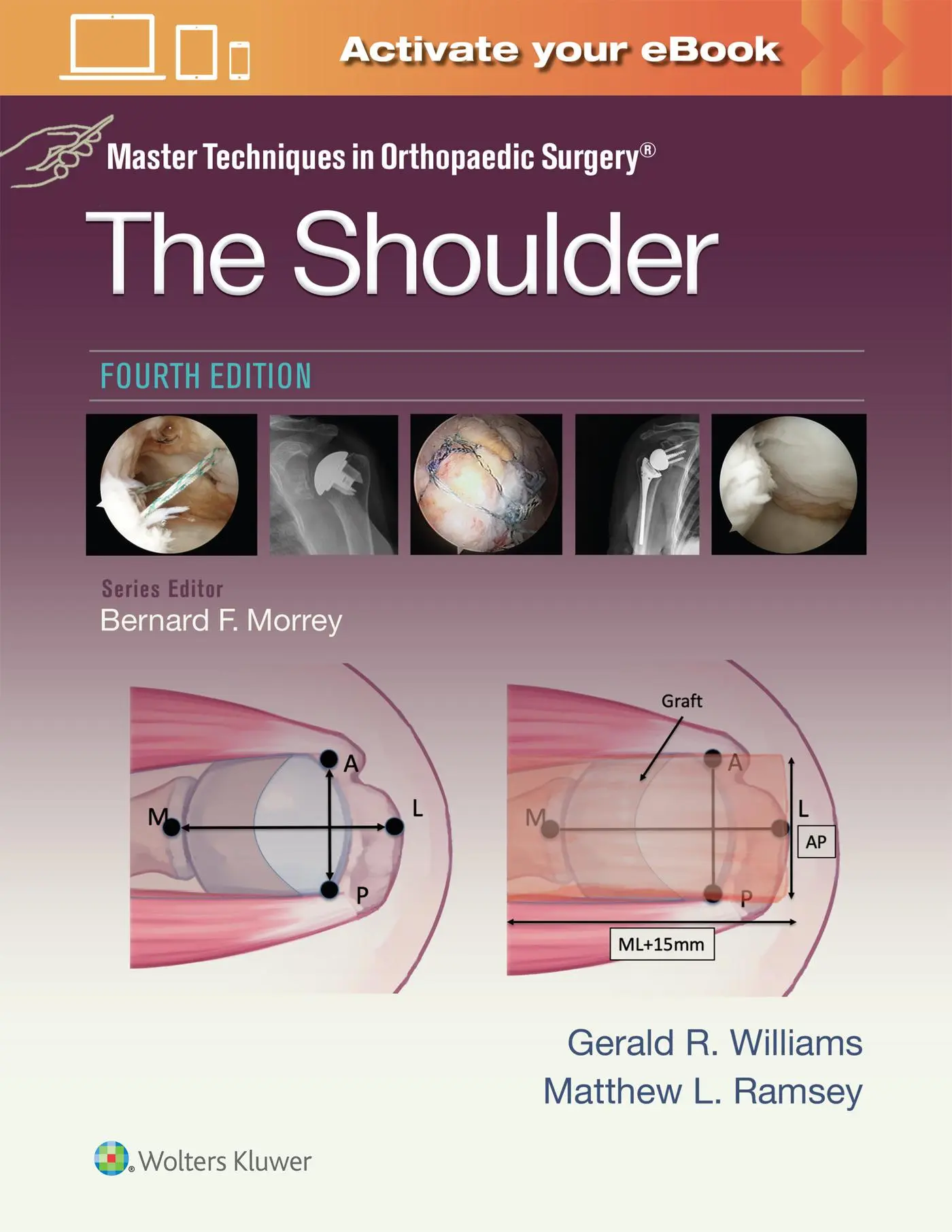 Cover: 9781975217969 | Master Techniques in Orthopaedic Surgery: The Shoulder: Print +...