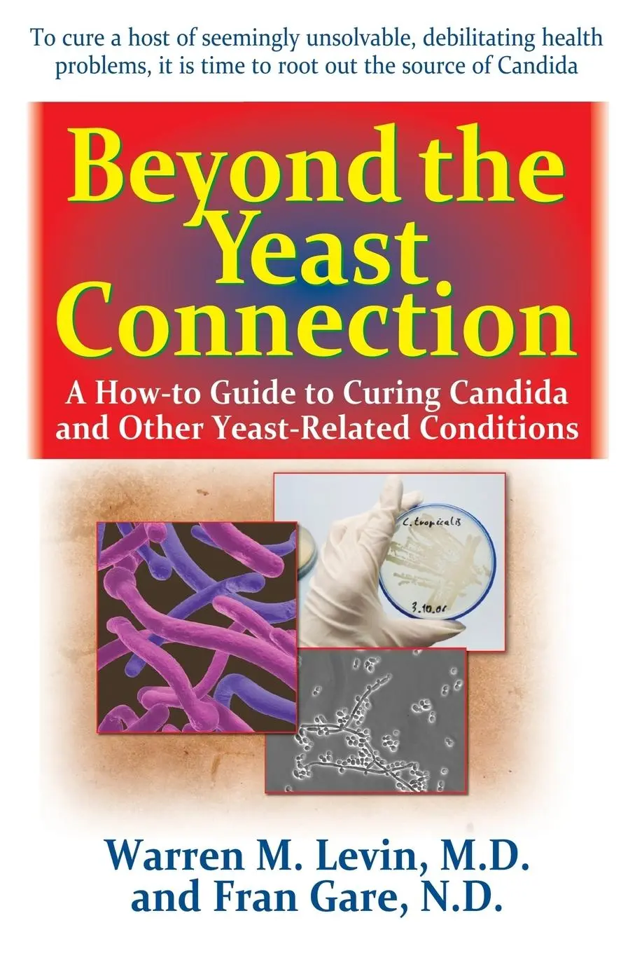Cover: 9781591203070 | Beyond the Yeast Connection | Warren M. Levin (u. a.) | Taschenbuch