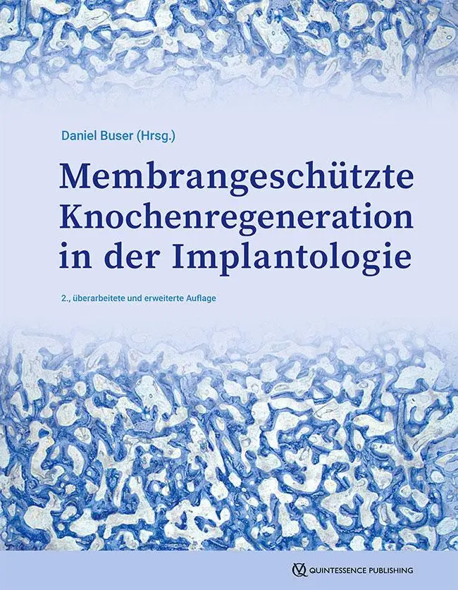 Cover: 9783868675870 | GBR-Technik in der Implantologie | Daniel Buser | Buch | 352 S. | 2025