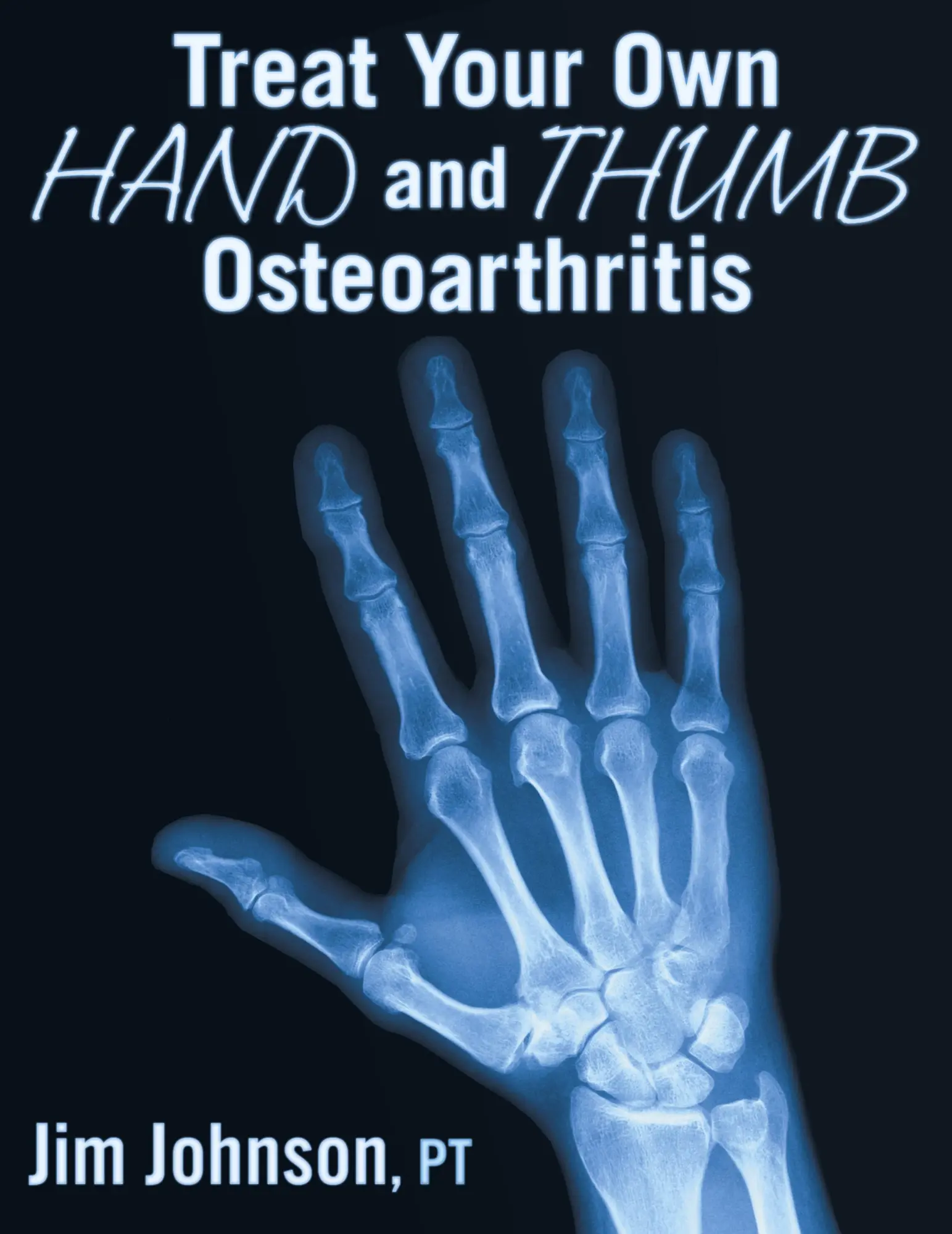 Cover: 9781642376470 | Treat Your Own Hand and Thumb Osteoarthritis | Jim Johnson | Buch