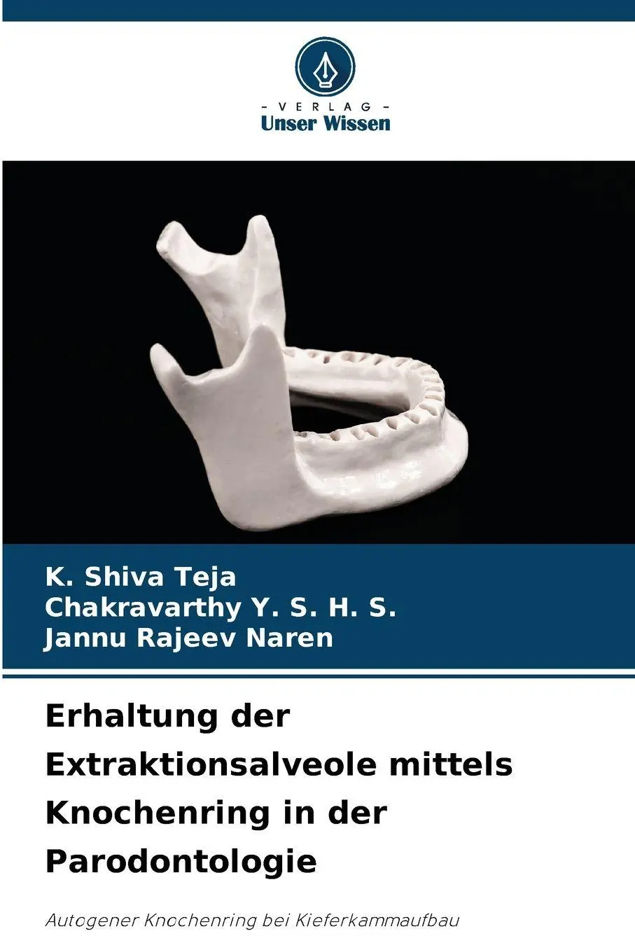 Cover: 9786209278570 | Erhaltung der Extraktionsalveole mittels Knochenring in der...