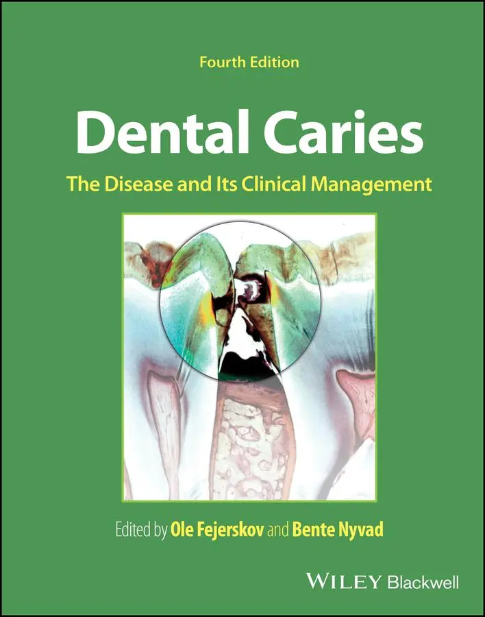 Cover: 9781119679370 | Dental Caries | The Disease and Its Clinical Management | Buch | 2024
