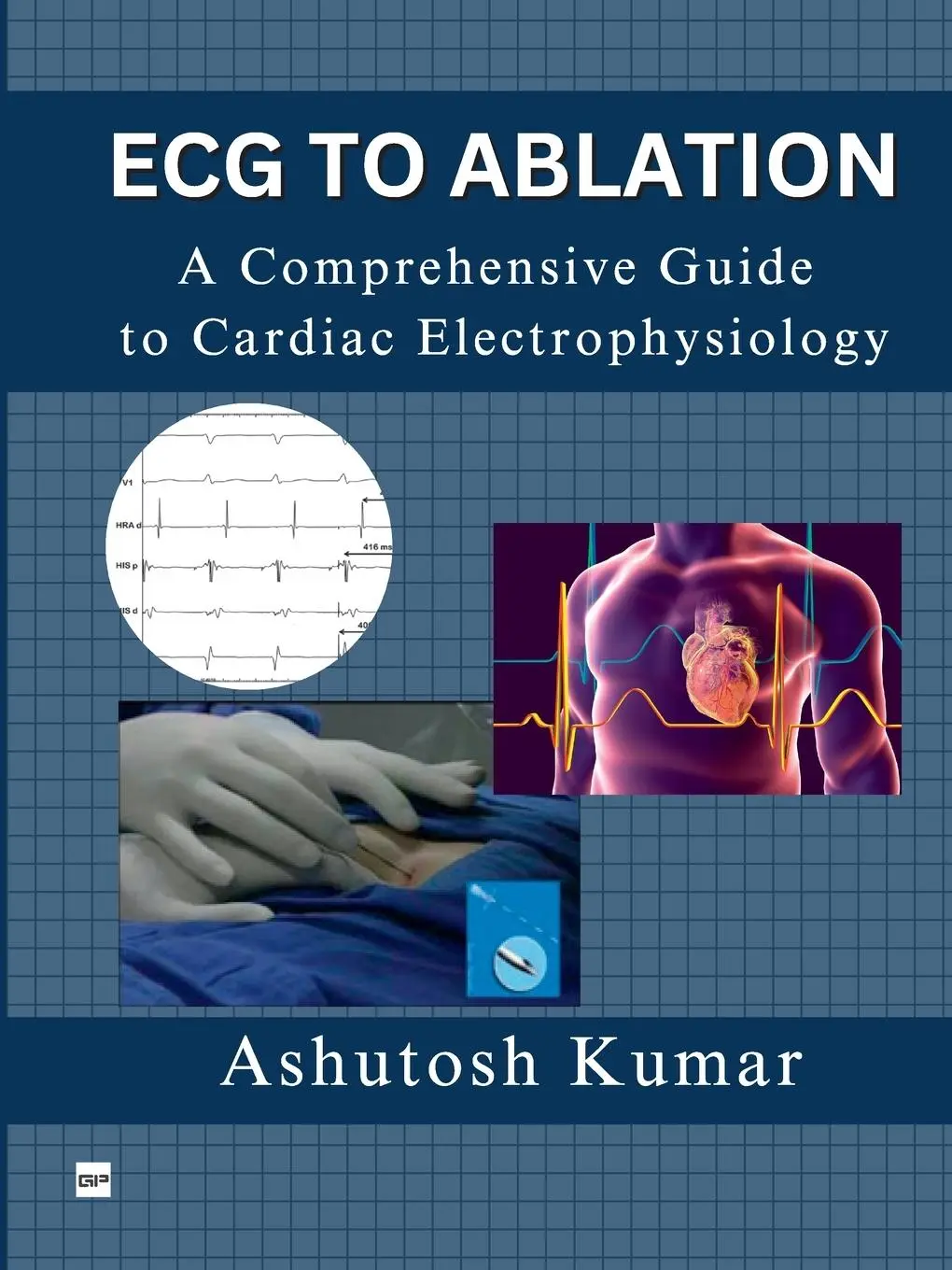 Cover: 9788119170371 | ECG TO ABLATION | A COMPREHENSIVE GUIDE TO CARDIAC ELECTROPHYSIOLOGY