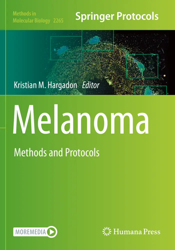 Cover: 9781071612071 | Melanoma | Methods and Protocols | Kristian M. Hargadon | Taschenbuch