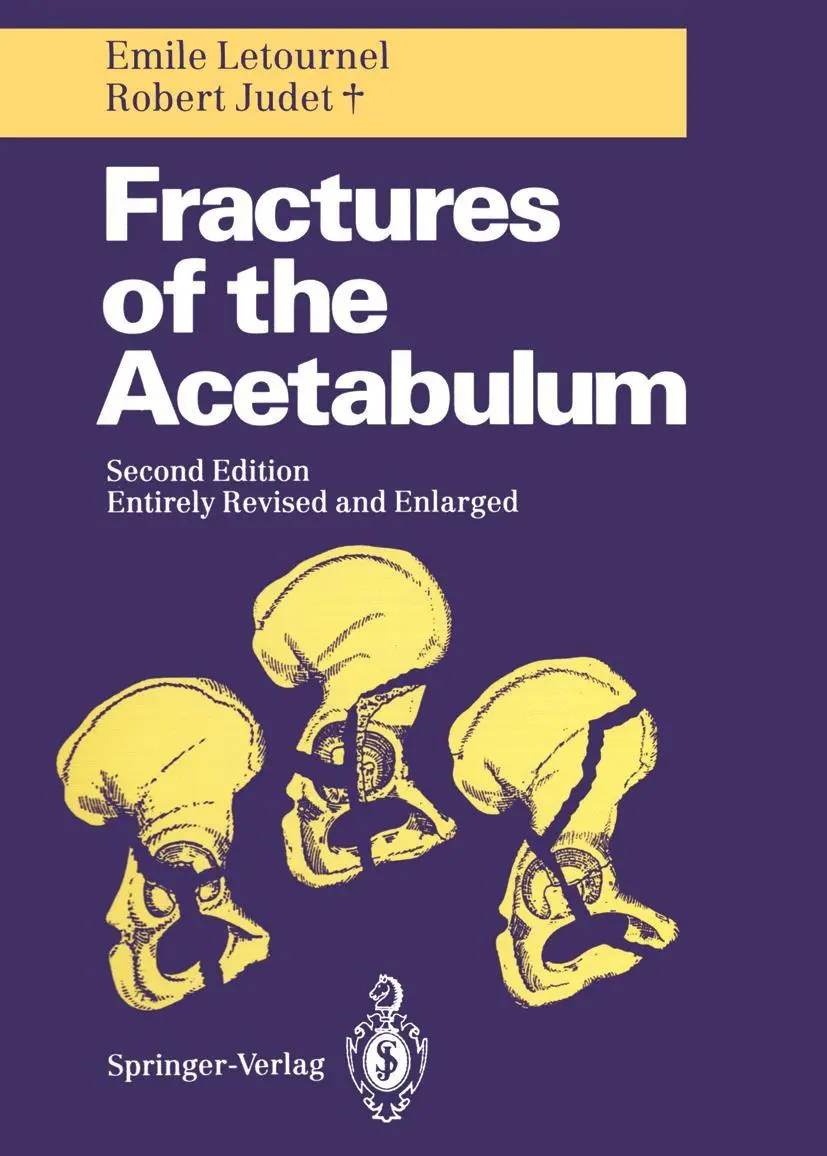 Cover: 9783642754371 | Fractures of the Acetabulum | Emile Letournel (u. a.) | Taschenbuch