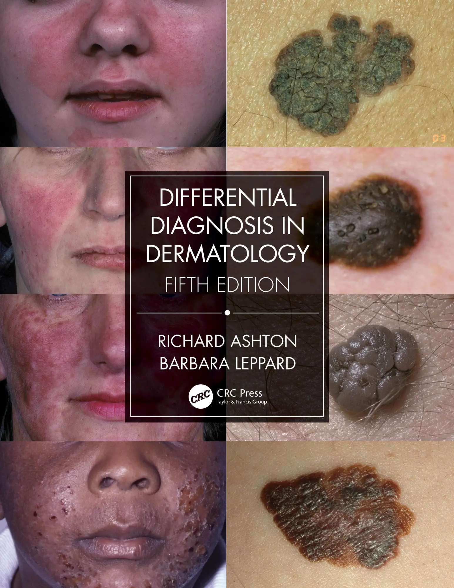 Cover: 9780367085971 | Differential Diagnosis in Dermatology | Barbara Leppard (u. a.) | Buch Cover: 9780367085971 | Differential Diagnosis in Dermatology | Barbara Leppard (u. a.) | Buch