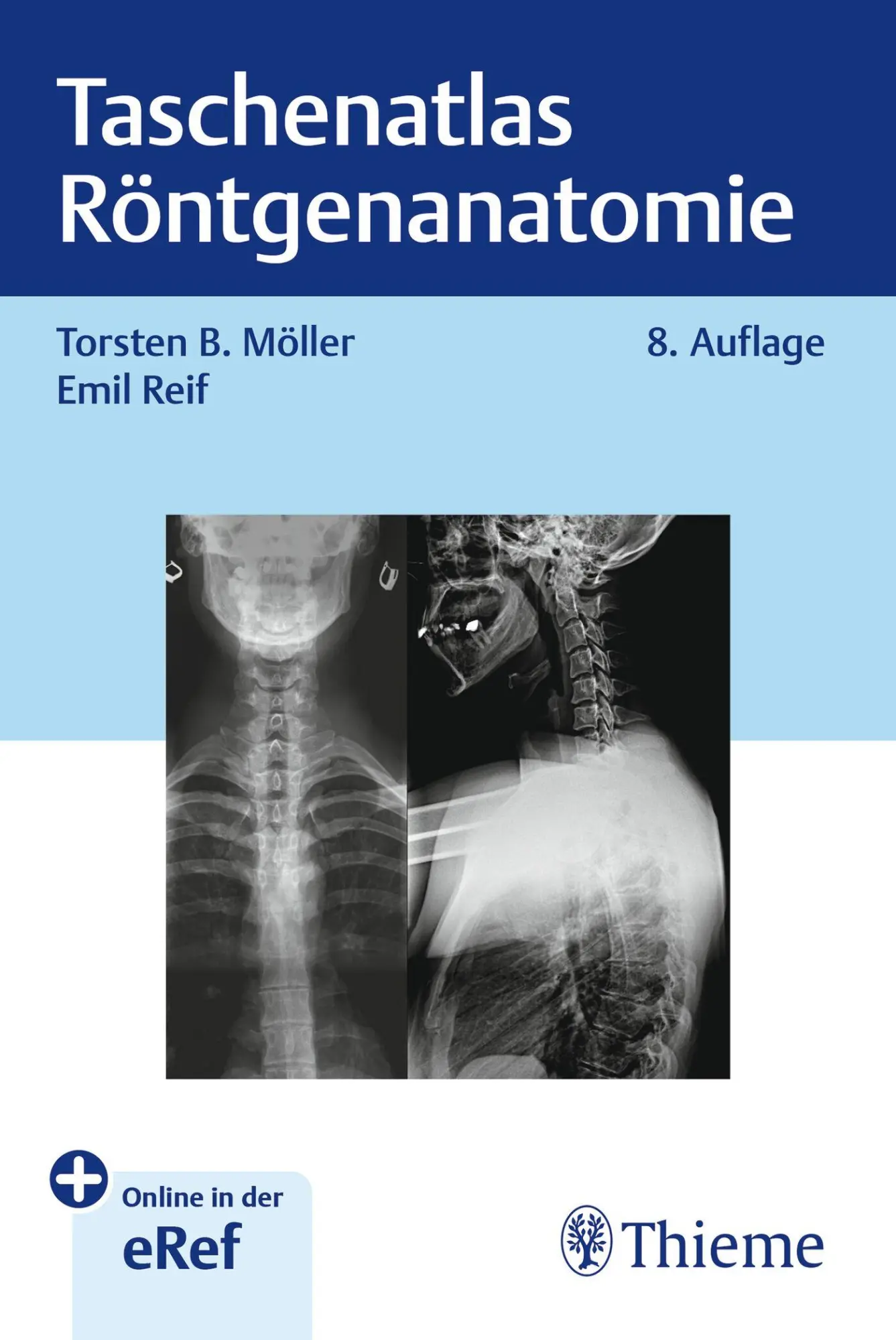 Cover: 9783132460072 | Taschenatlas Röntgenanatomie | Torsten Bert Möller (u. a.) | Bundle