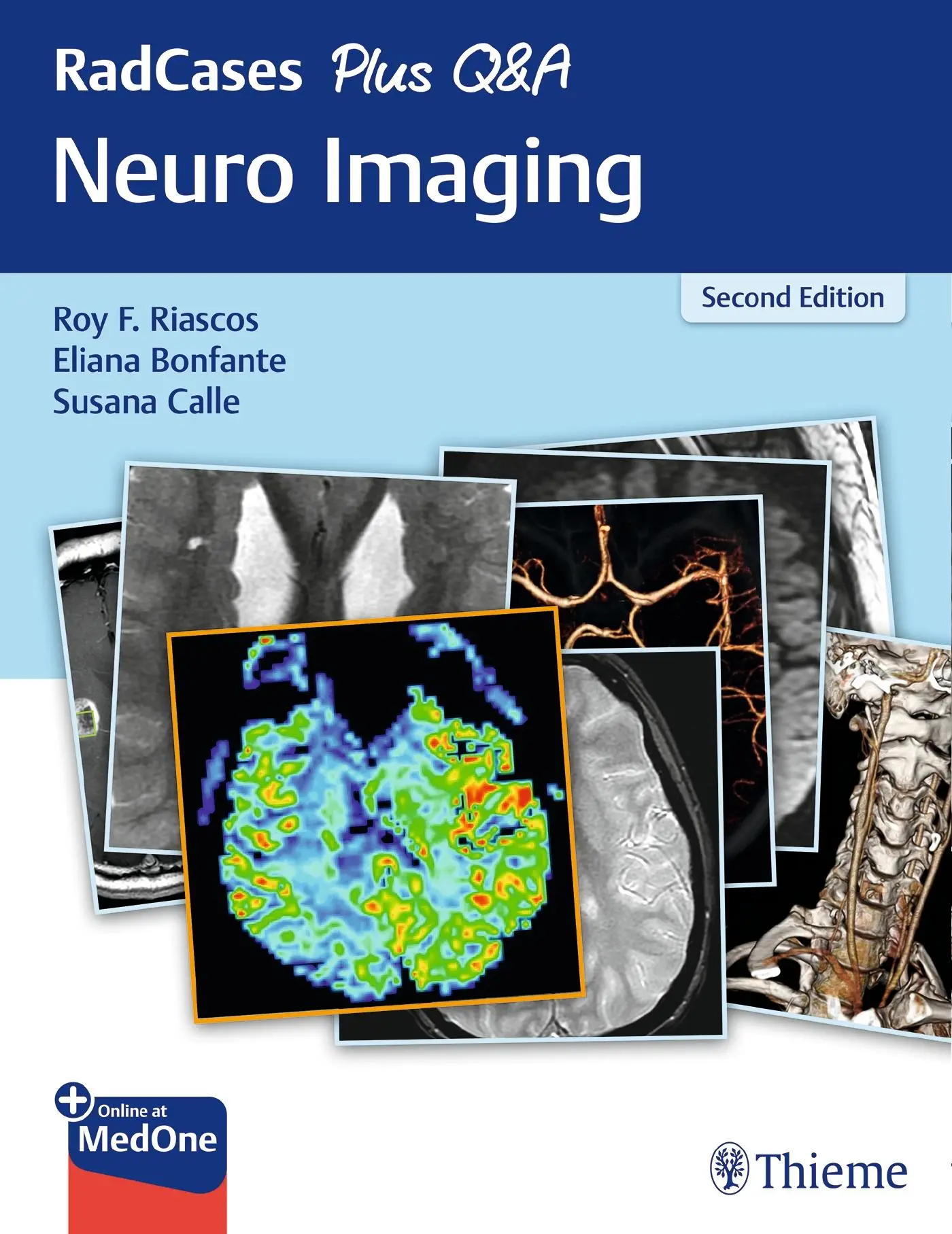 Cover: 9781626232372 | Radcases Plus Q&amp;A Neuro Imaging | Roy F Riascos-Castaneda (u. a.)