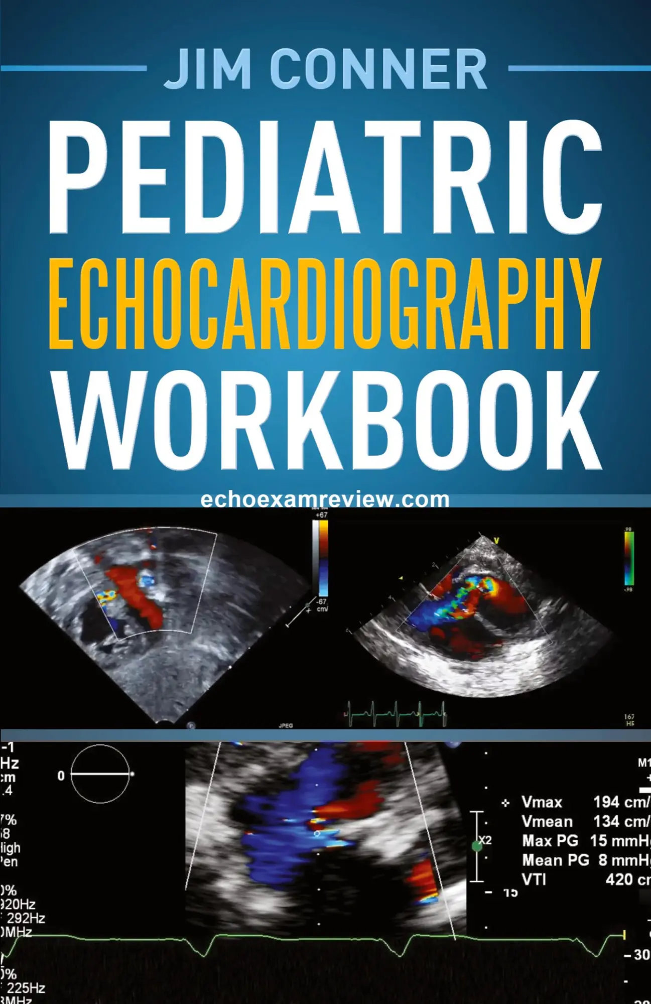 Cover: 9781642375572 | Pediatric Echocardiography Workbook | Jim Conner | Taschenbuch | 2019