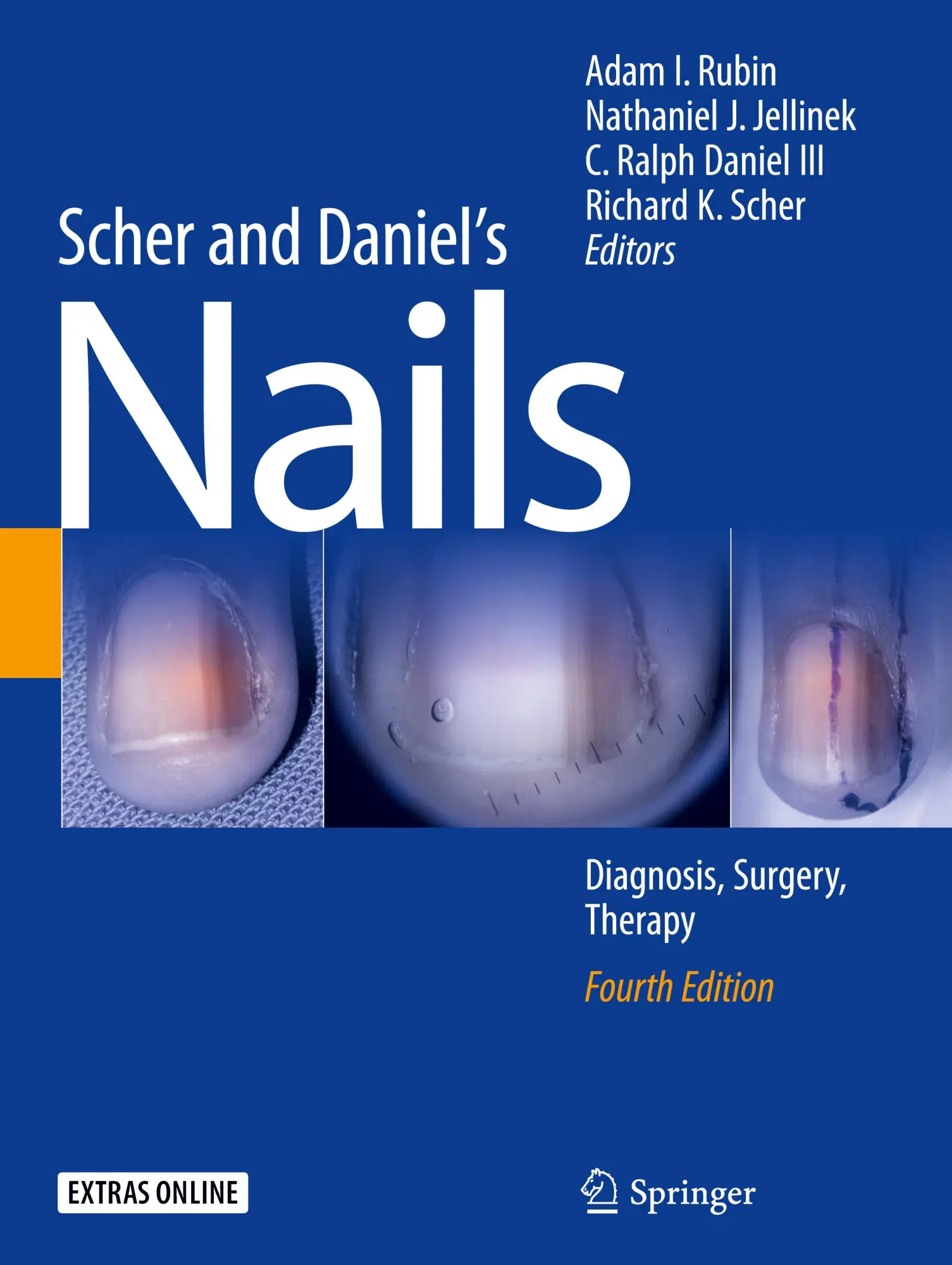 Cover: 9783319656472 | Scher and Daniel's Nails | Diagnosis, Surgery, Therapy | Rubin (u. a.)