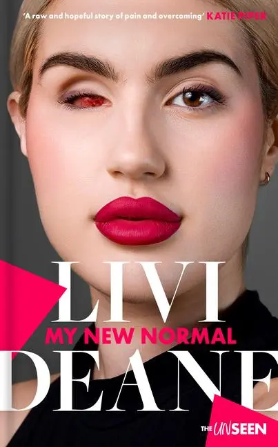 Cover: 9780281088072 | My New Normal | Learning to Celebrate What's Different about You
