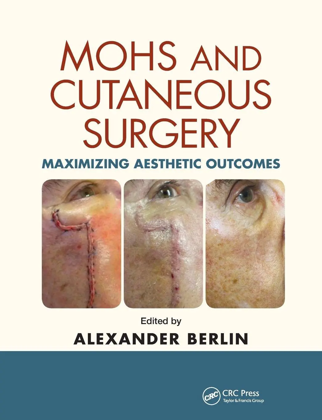 Cover: 9780367378172 | Mohs and Cutaneous Surgery | Maximizing Aesthetic Outcomes | Berlin
