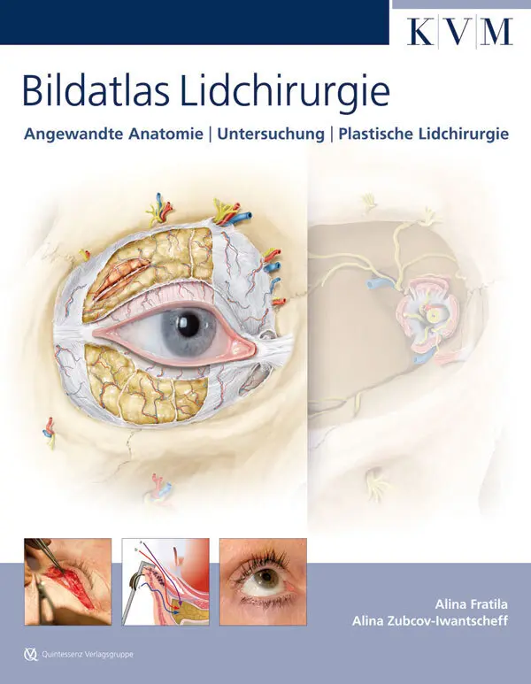 Cover: 9783940698872 | Bildatlas Lidchirurgie | Alina Fratila (u. a.) | Buch | XIII | Deutsch