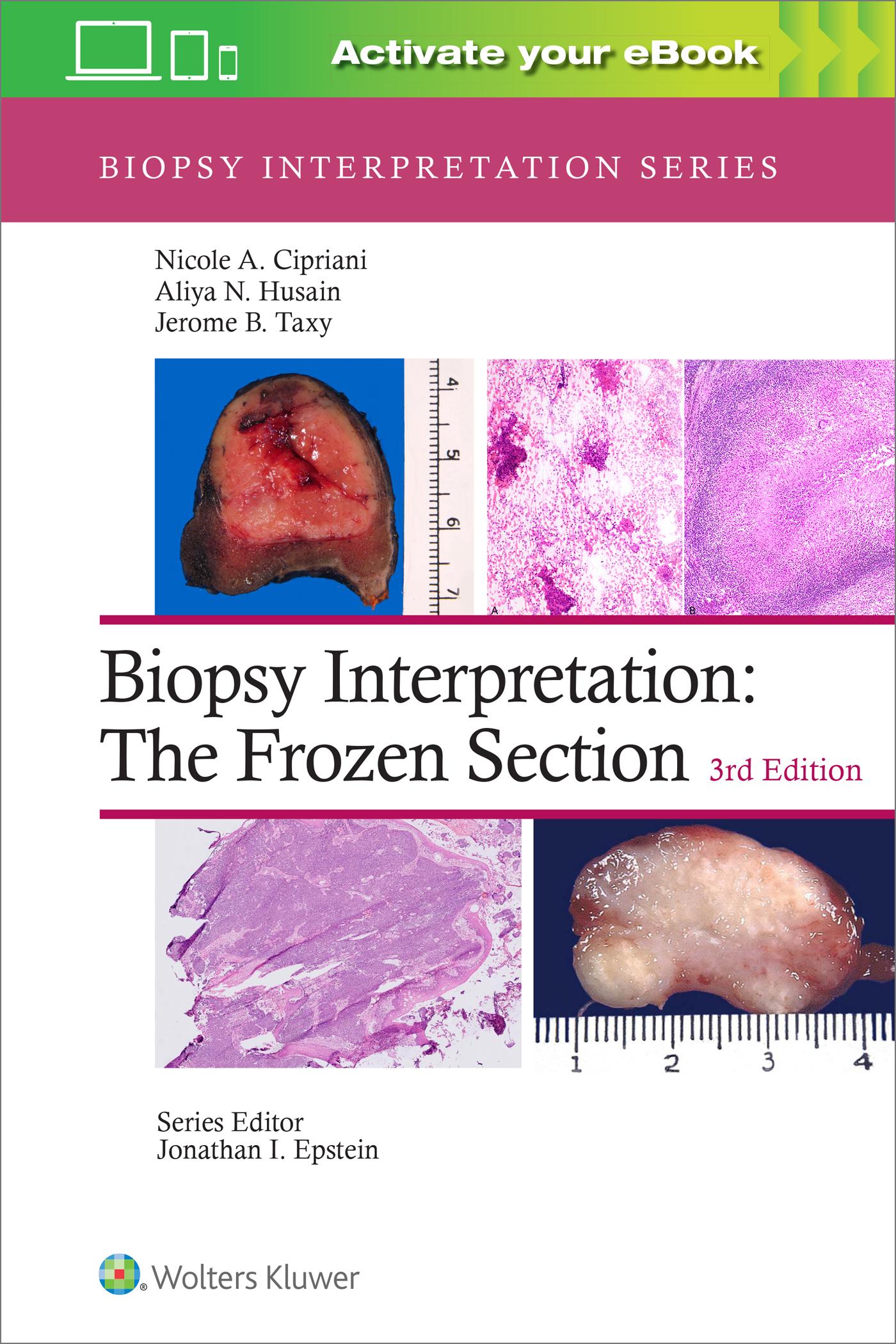 Cover: 9781975170073 | Biopsy Interpretation: The Frozen Section: Print + eBook with...