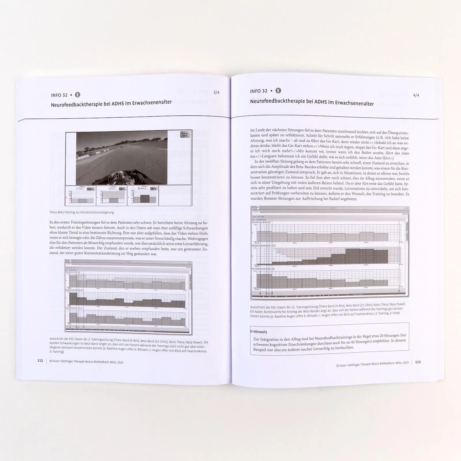 Bild: 9783621290173 | Therapie-Basics Biofeedback | Mit E-Book inside und Arbeitsmaterial