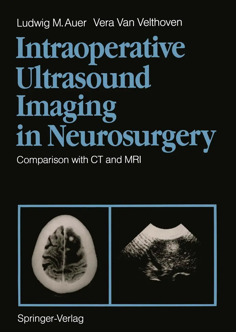 Cover: 9783642740473 | Intraoperative Ultrasound Imaging in Neurosurgery | Velthoven (u. a.)