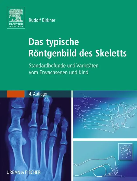 Cover: 9783437313073 | Das typische Röntgenbild des Skeletts | Rudolf Birkner | Taschenbuch