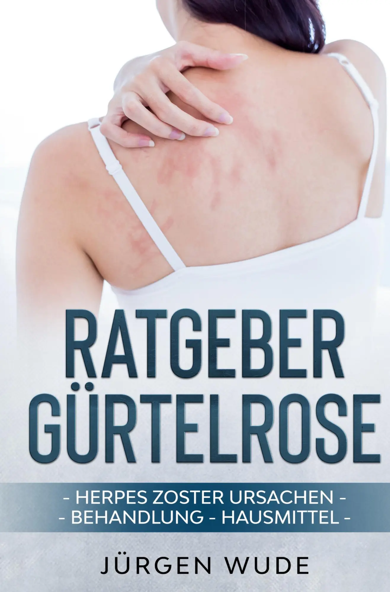 Cover: 9783757913373 | Ratgeber Gürtelrose | Herpes Zoster Ursachen Behandlung Hausmittel