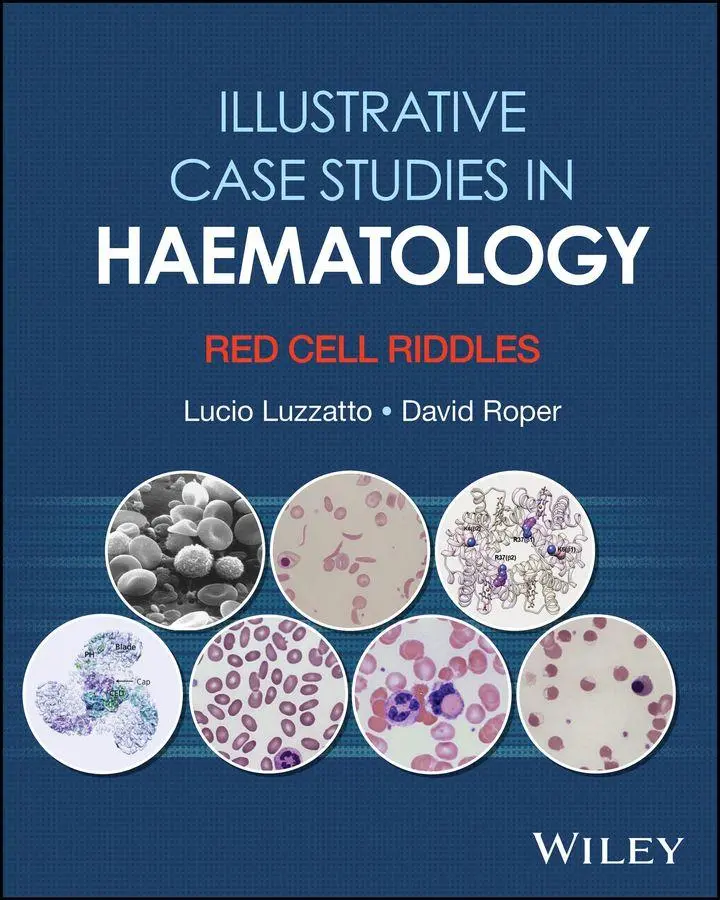 Cover: 9781394354573 | Illustrative Case Studies in Haematology | Red Cell Riddles | Buch