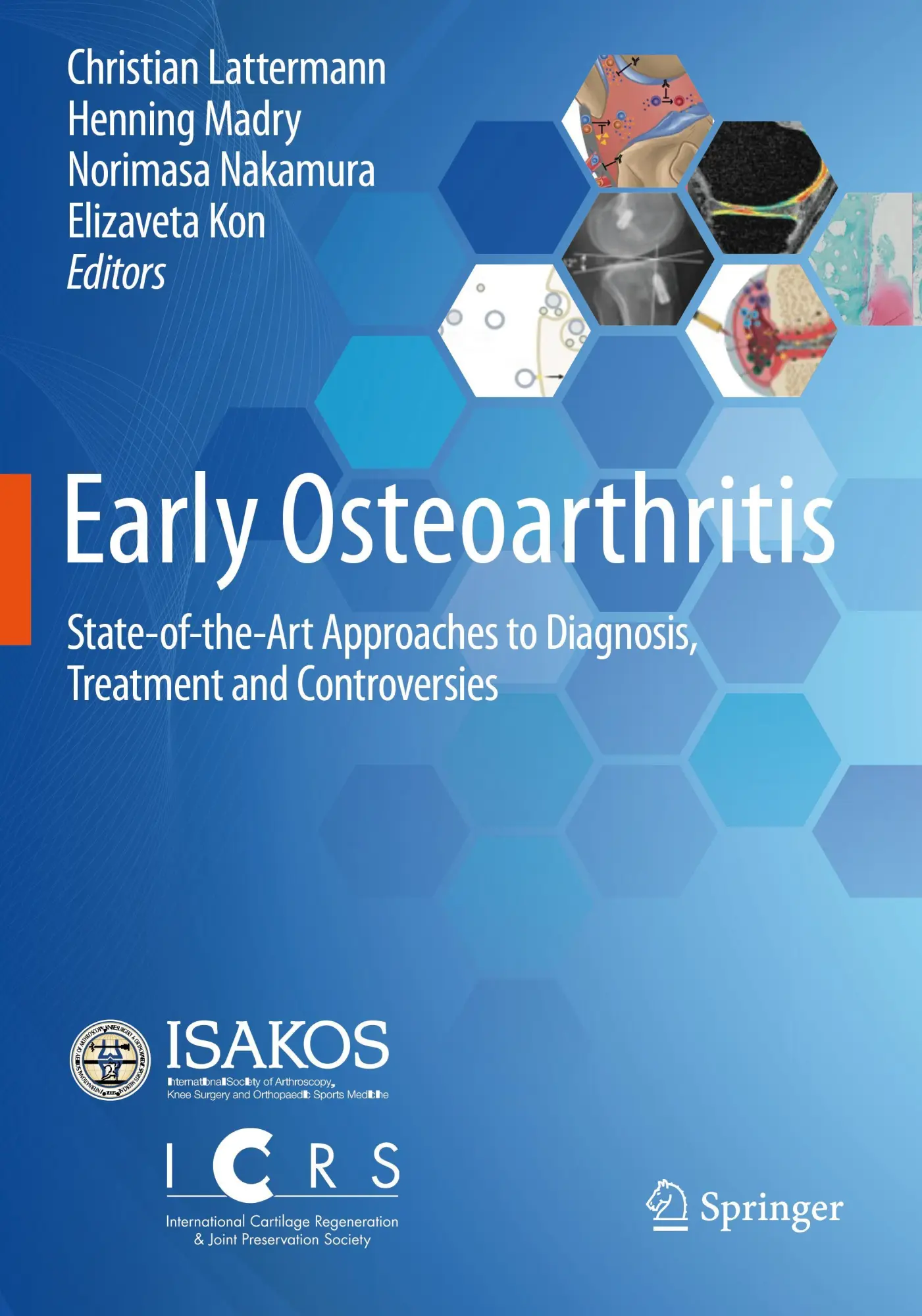 Cover: 9783030794873 | Early Osteoarthritis | Christian Lattermann (u. a.) | Taschenbuch | ix