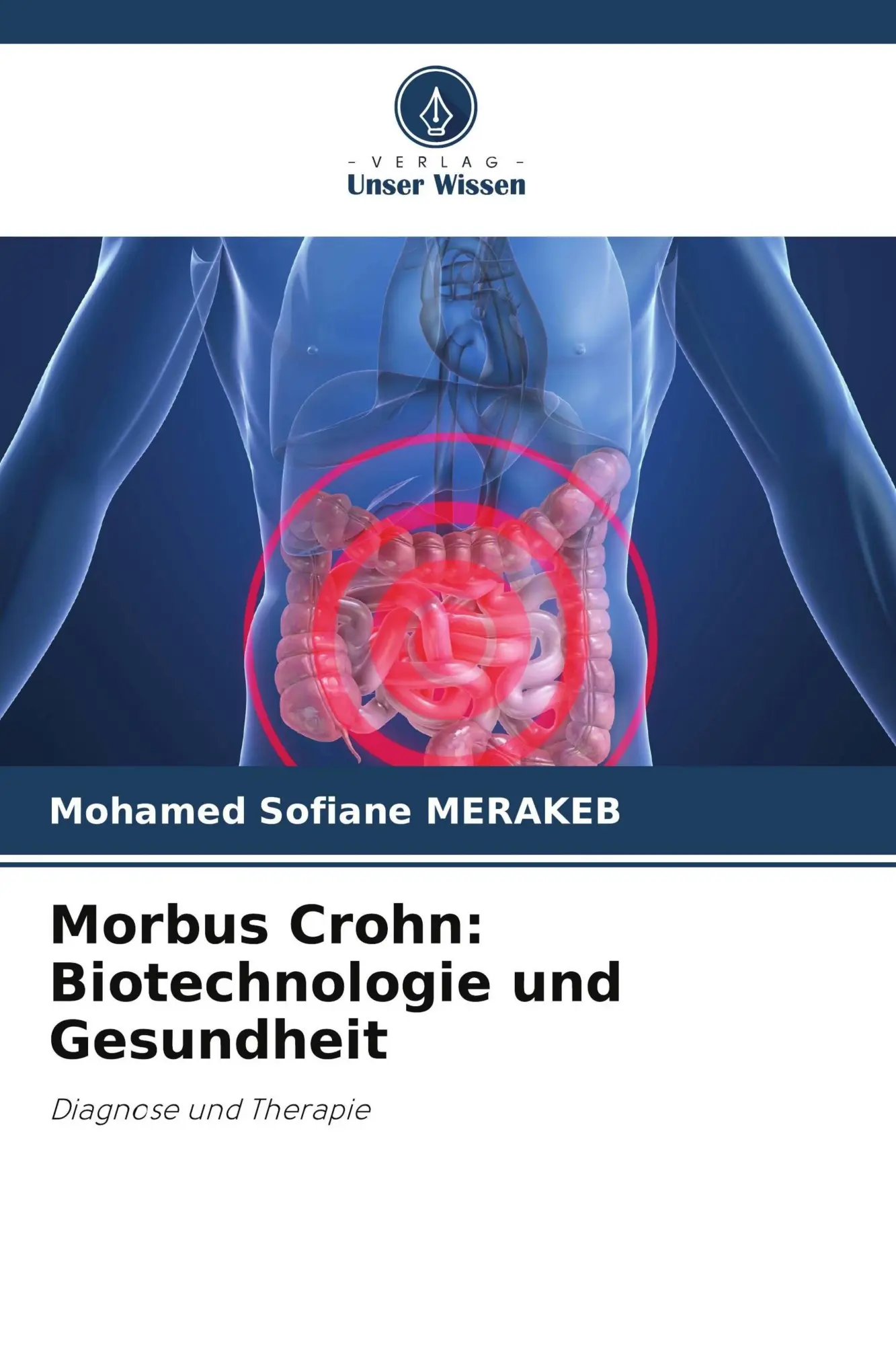 Cover: 9786209546273 | Morbus Crohn: Biotechnologie und Gesundheit | Diagnose und Therapie