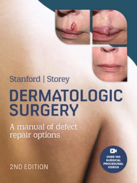 Cover: 9781743768273 | Dermatologic Surgery | Duncan Stanford (u. a.) | Buch | Gebunden