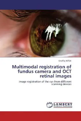 Cover: 9783659228773 | Multimodal registration of fundus camera and OCT retinal images | Buch