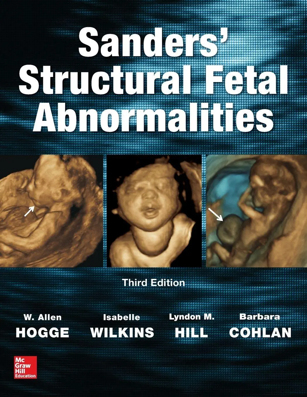 Cover: 9781259641374 | Sanders' Structural Fetal Abnormalities, Third Edition | Hogge (u. a.)