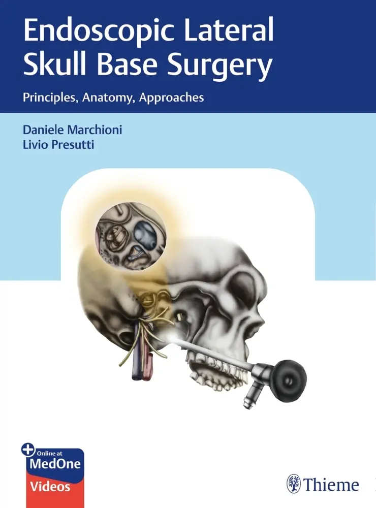 Cover: 9783132412774 | Endoscopic Lateral Skull Base Surgery | Daniele Marchioni (u. a.)
