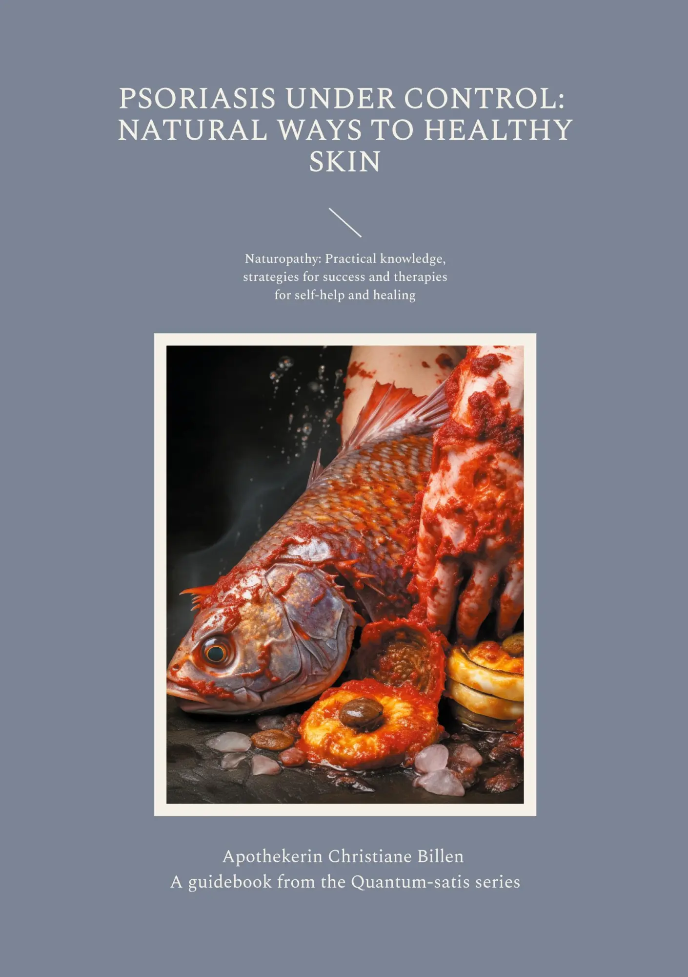 Cover: 9783756812974 | Psoriasis under control: Natural ways to healthy skin | Billen | Buch