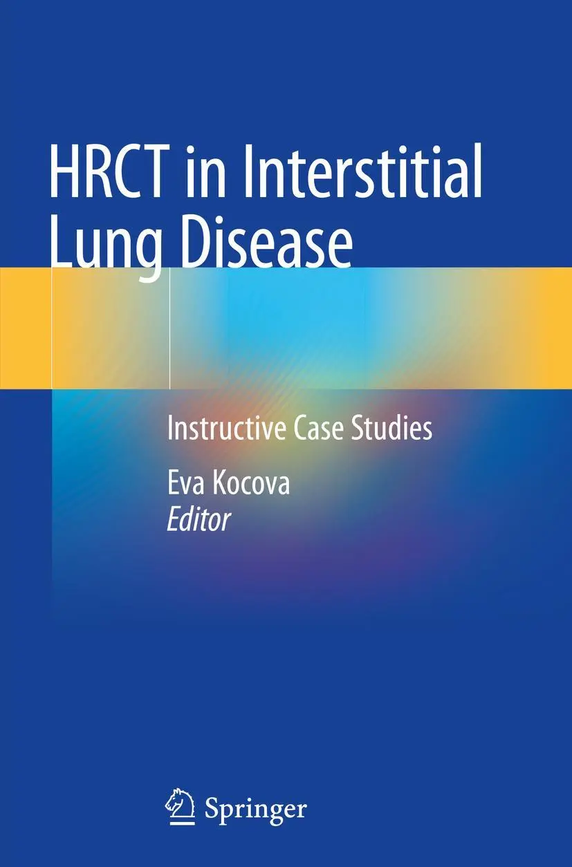 Cover: 9783030163174 | HRCT in Interstitial Lung Disease | Instructive Case Studies | Kocova