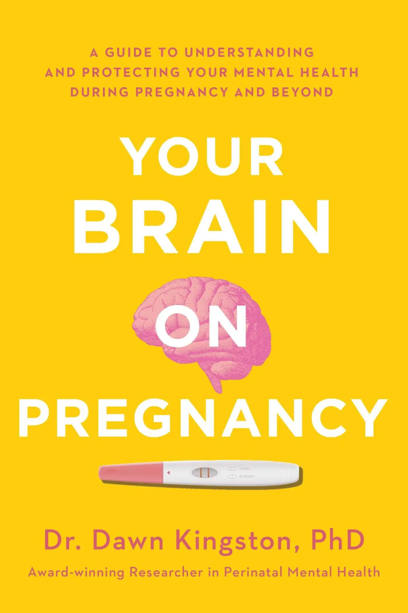 Cover: 9781982143374 | Your Brain on Pregnancy | Dawn Kingston | Taschenbuch | Englisch