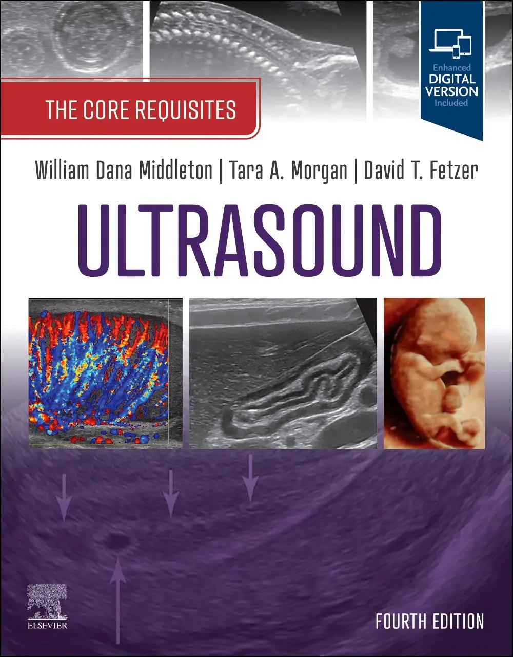 Cover: 9780323878074 | Ultrasound: The Core Requisites | The Core Requisites | Taschenbuch
