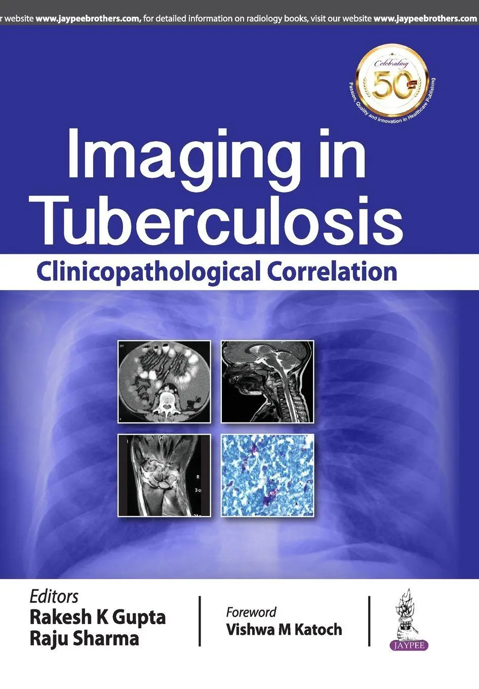 Cover: 9789388958974 | Imaging in Tuberculosis | Rakesh K Gupta (u. a.) | Taschenbuch | 2019