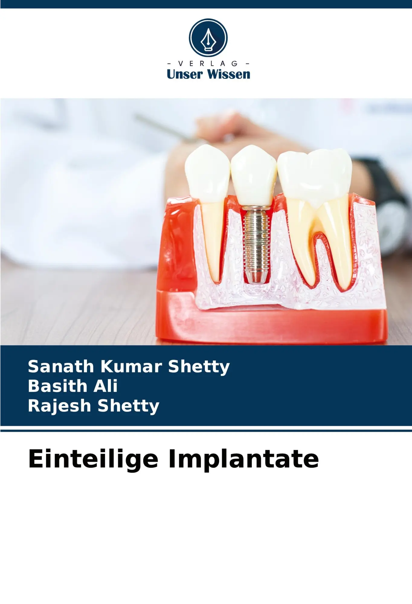 Cover: 9786203890075 | Einteilige Implantate | Sanath Kumar Shetty (u. a.) | Taschenbuch
