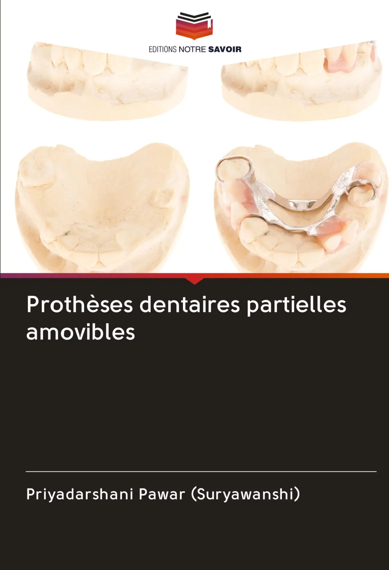 Cover: 9786203010275 | Prothèses dentaires partielles amovibles | Priyadarshani Pawar | Buch
