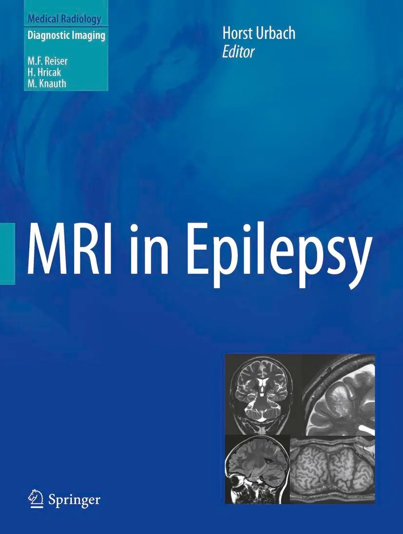 Cover: 9783642251375 | MRI in Epilepsy | Horst Urbach | Buch | xiii | Englisch | 2013