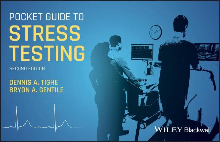 Cover: 9781119481775 | Pocket Guide to Stress Testing | Dennis A Tighe (u. a.) | Taschenbuch