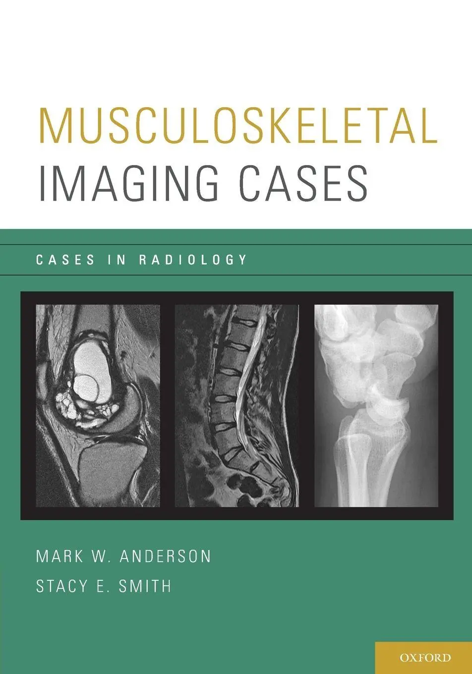 Cover: 9780195394375 | Musculoskeletal Imaging Cases | Mark W. Anderson (u. a.) | Taschenbuch