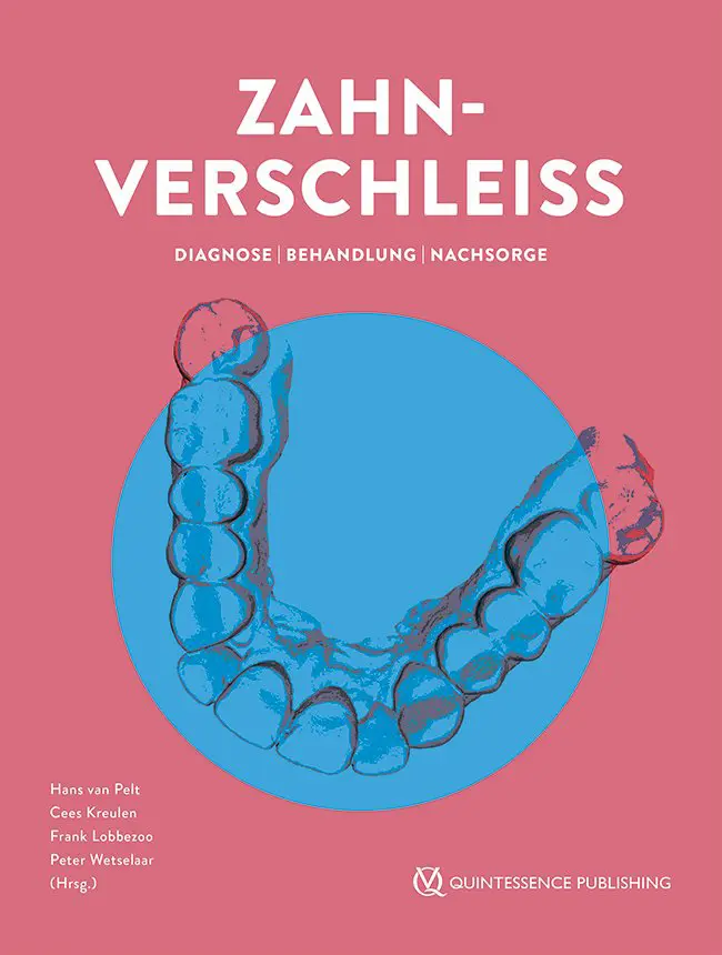 Cover: 9783868676075 | Zahnverschleiß | Diagnose Behandlung Nachsorge | Hans van Pelt (u. a.)