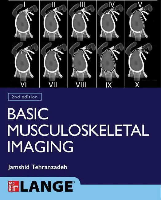 Cover: 9781260459975 | Basic Musculoskeletal Imaging, Second Edition | Jamshid Tehranzadeh