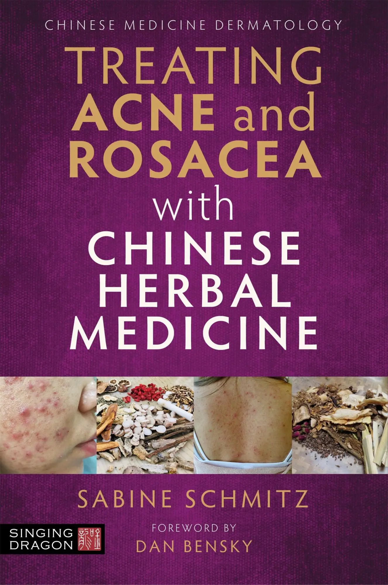 Cover: 9781787752276 | Treating Acne and Rosacea with Chinese Herbal Medicine | Schmitz