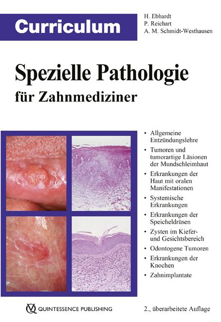 Cover: 9783868673876 | Curriculum Spezielle Pathologie für Zahnmediziner | Ebhardt (u. a.)