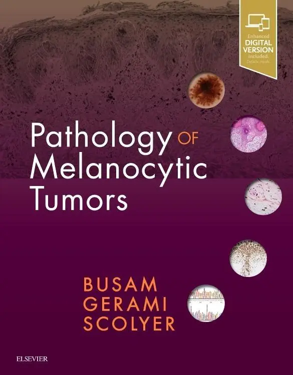 Cover: 9780323374576 | Pathology of Melanocytic Tumors | Klaus J Busam (u. a.) | Buch | 2018