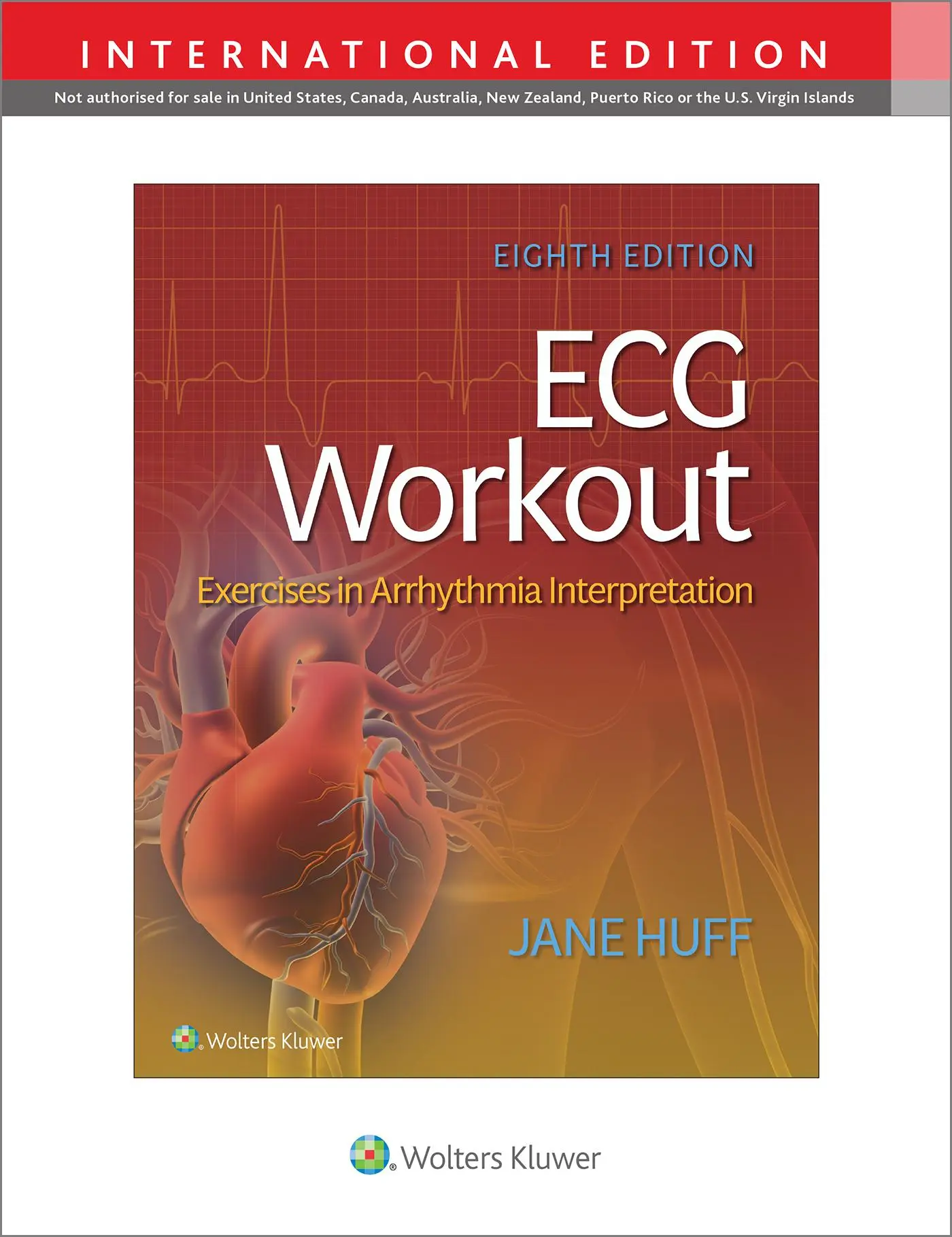Cover: 9781975174576 | ECG Workout | Exercises in Arrythmia Interpretation | Jane Huff | Buch