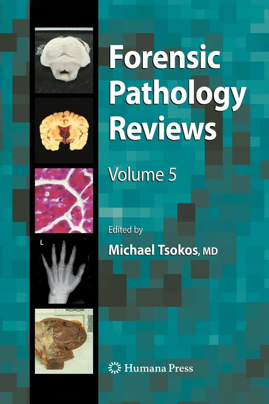 Cover: 9781617377976 | Forensic Pathology Reviews 5 | Michael Tsokos | Taschenbuch | xvi